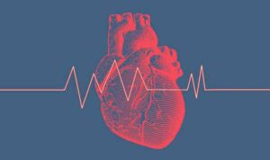 Seven-Figure Settlement for Failure to Diagnose Heart Condition